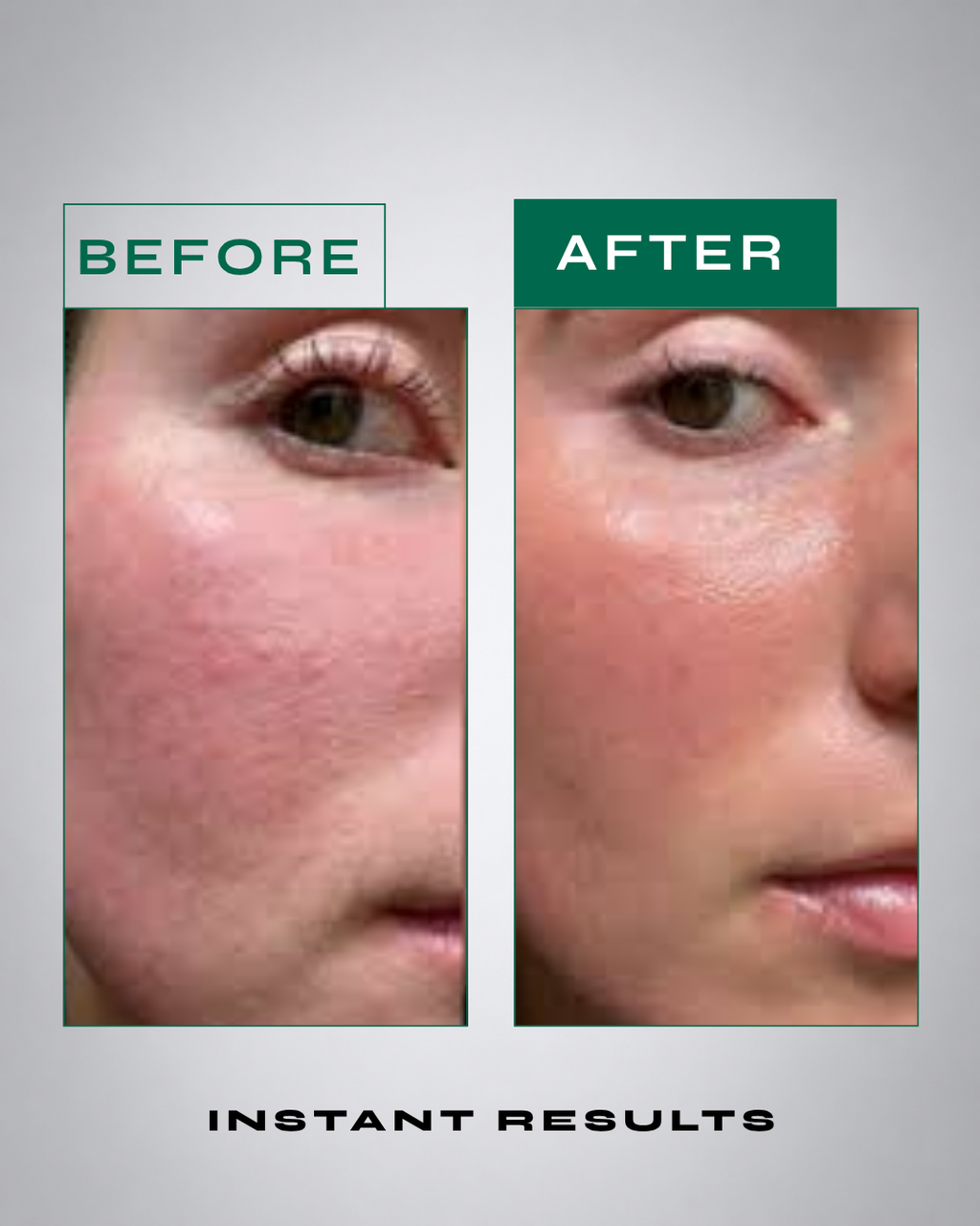 Skinergy serum application on skin – visible plumping effect