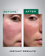 Skinergy serum application on skin – visible plumping effect